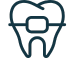 Apparecchio - Ortodonzia - Dentista Santarcangelo di Romagna