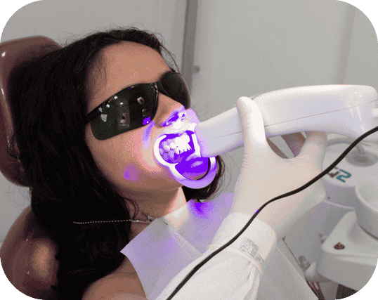 Sbiancamento denti Santarcangelo | Studio dentistico Omnia